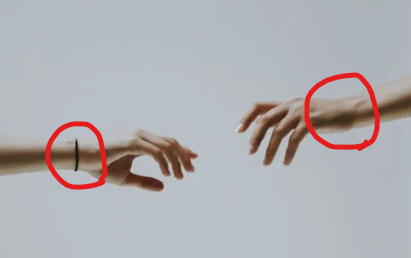 골프 엘보 증상 주요 위치